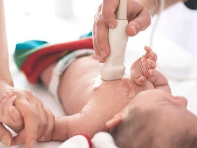 dr amar upadhyay pediatric echo